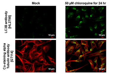 Anti-LC3B antibody [HL2798] used in Immunocytochemistry/ Immunofluorescence (ICC/IF). GTX639686