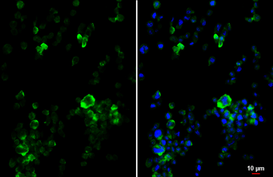 Anti-P2Y2 antibody [HL2801] used in Immunocytochemistry/ Immunofluorescence (ICC/IF). GTX639689