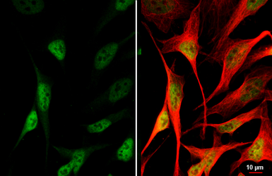 Anti-Mre11 antibody [HL1386-MS] used in Immunocytochemistry/ Immunofluorescence (ICC/IF). GTX639690