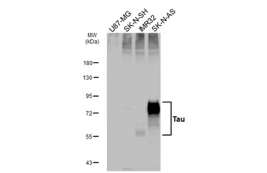 Anti-Tau antibody [HL2802] used in Western Blot (WB). GTX639694