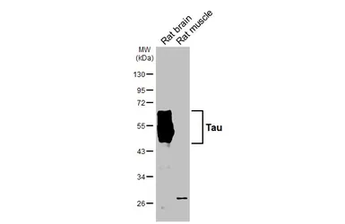 Anti-Tau antibody [HL2802] used in Western Blot (WB). GTX639694