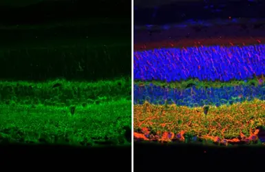 Anti-Tau antibody [HL2802] used in IHC (Paraffin sections) (IHC-P). GTX639694