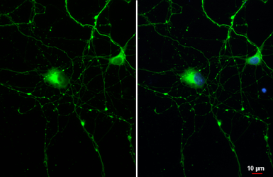 Anti-Tau antibody [HL2802] used in Immunocytochemistry/ Immunofluorescence (ICC/IF). GTX639694