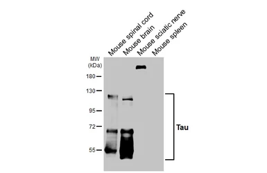 Anti-Tau antibody [HL2802] used in Western Blot (WB). GTX639694