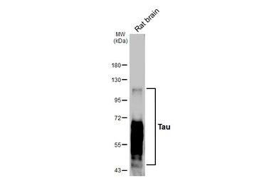 Anti-Tau antibody [HL2802] used in Western Blot (WB). GTX639694