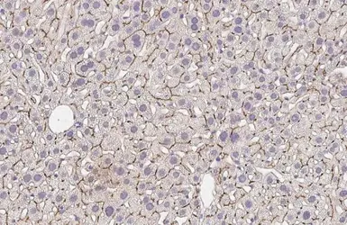 Anti-BSEP antibody [HL2803] used in IHC (Paraffin sections) (IHC-P). GTX639695