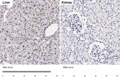 Anti-BSEP antibody [HL2803] used in IHC (Paraffin sections) (IHC-P). GTX639695