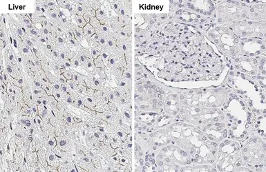 Anti-BSEP antibody [HL2803] used in IHC (Paraffin sections) (IHC-P). GTX639695
