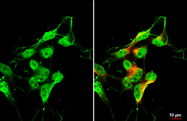 Anti-Islet 1 antibody [HL2807] used in Immunocytochemistry/ Immunofluorescence (ICC/IF). GTX639917