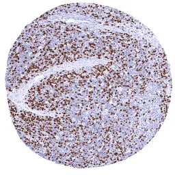 Anti-Thymidylate synthase antibody [HMV305] HistoMAX&trade; used in IHC (Paraffin sections) (IHC-P). GTX639929