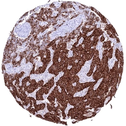 Anti-Insulin antibody [HMV308] HistoMAX&trade; used in IHC (Paraffin sections) (IHC-P). GTX639932