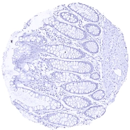 Anti-Insulin antibody [HMV308] HistoMAX&trade; used in IHC (Paraffin sections) (IHC-P). GTX639932