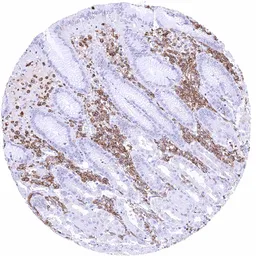 Anti-CD32B antibody [HMV315] HistoMAX&trade; used in IHC (Paraffin sections) (IHC-P). GTX639939