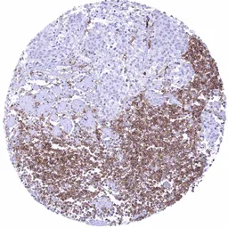 Anti-CD32B antibody [HMV315] HistoMAX&trade; used in IHC (Paraffin sections) (IHC-P). GTX639939