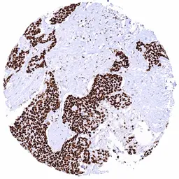 Anti-HMGB1 antibody [HMV317] HistoMAX&trade; used in IHC (Paraffin sections) (IHC-P). GTX639941