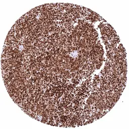 Anti-HMGB1 antibody [HMV317] HistoMAX&trade; used in IHC (Paraffin sections) (IHC-P). GTX639941