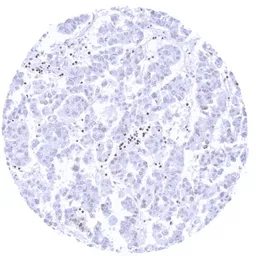Anti-HMGB1 antibody [HMV317] HistoMAX&trade; used in IHC (Paraffin sections) (IHC-P). GTX639941