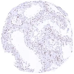 Anti-HMGB1 antibody [HMV317] HistoMAX&trade; used in IHC (Paraffin sections) (IHC-P). GTX639941