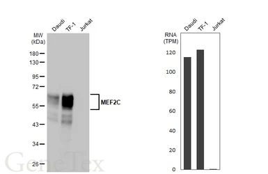 Anti-MEF2C antibody [HL2811] used in Western Blot (WB). GTX639952
