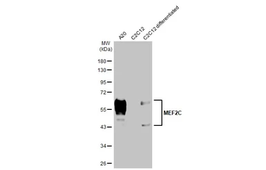 Anti-MEF2C antibody [HL2811] used in Western Blot (WB). GTX639952