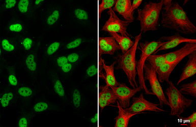 Anti-MEF2C antibody [HL2811] used in Immunocytochemistry/ Immunofluorescence (ICC/IF). GTX639952
