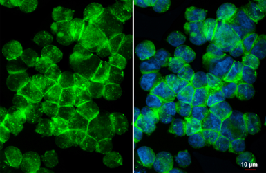 Anti-P2Y11 antibody [HL2821] used in Immunocytochemistry/ Immunofluorescence (ICC/IF). GTX640092