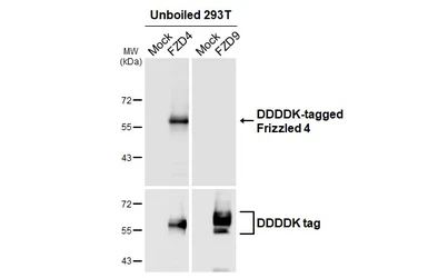 Anti-Frizzled 4 antibody [HL2824] used in Western Blot (WB). GTX640095