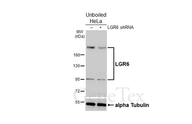 Anti-LGR6 antibody [HL2827] used in Western Blot (WB). GTX640098