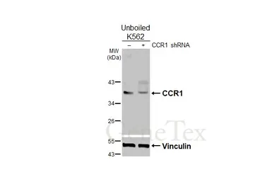 Anti-CCR1 antibody [HL2840] used in Western Blot (WB). GTX640111
