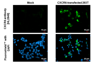 Anti-CXCR6 antibody [HL2849] used in Immunocytochemistry/ Immunofluorescence (ICC/IF). GTX640120