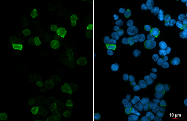 Anti-CXCR6 antibody [HL2849] used in Immunocytochemistry/ Immunofluorescence (ICC/IF). GTX640120
