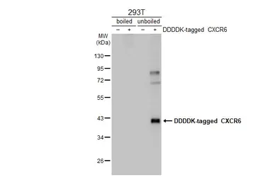 Anti-CXCR6 antibody [HL2849] used in Western Blot (WB). GTX640120