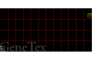 Anti-CCR10 antibody [HL2853] used in Functional Assay (Functional Assay). GTX640124
