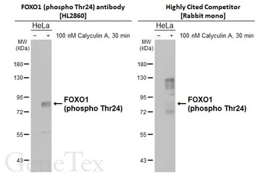 Anti-FOXO1 (phospho Thr24) antibody [HL2860] used in Western Blot (WB). GTX640131