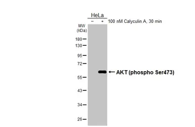 Anti-AKT (phospho Ser473) antibody [HL2871] used in Western Blot (WB). GTX640148