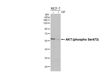 Anti-AKT (phospho Ser473) antibody [HL2871] used in Western Blot (WB). GTX640148
