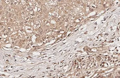 Anti-AKT (phospho Ser473) antibody [HL2871] used in IHC (Paraffin sections) (IHC-P). GTX640148