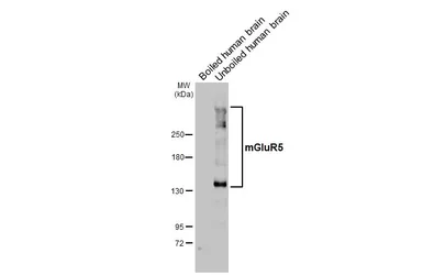 Anti-mGluR5 antibody [HL2876] used in Western Blot (WB). GTX640153