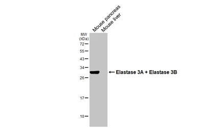 Anti-Elastase 3A +  Elastase 3B antibody [HL2882] used in Western Blot (WB). GTX640161