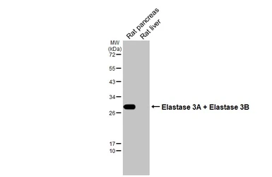 Anti-Elastase 3A +  Elastase 3B antibody [HL2882] used in Western Blot (WB). GTX640161
