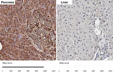 Anti-Elastase 3A +  Elastase 3B antibody [HL2882] used in IHC (Paraffin sections) (IHC-P). GTX640161