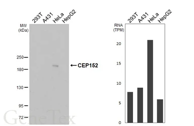 Anti-CEP152 antibody [HL2884] used in Western Blot (WB). GTX640163