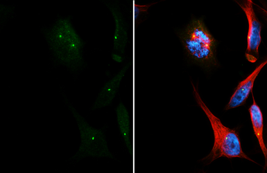 Anti-CEP152 antibody [HL2884] used in Immunocytochemistry/ Immunofluorescence (ICC/IF). GTX640163