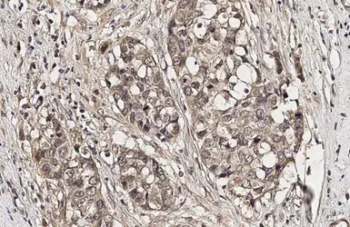 Anti-FOXO1 (phospho Ser256) antibody [HL2887] used in IHC (Paraffin sections) (IHC-P). GTX640166
