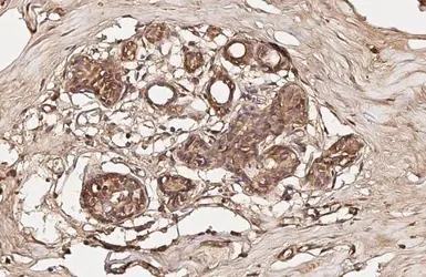 Anti-FOXO1 (phospho Ser256) antibody [HL2887] used in IHC (Paraffin sections) (IHC-P). GTX640166