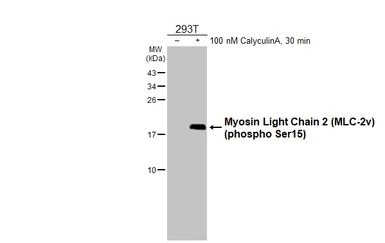 Anti-Myosin Light Chain 2 (MLC-2v) (phospho Ser15) antibody [HL2891] used in Western Blot (WB). GTX640170