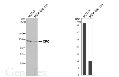 Anti-XPC antibody [HL2892] used in Western Blot (WB). GTX640229