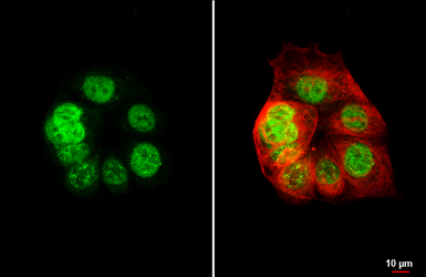 Anti-XPC antibody [HL2892] used in Immunocytochemistry/ Immunofluorescence (ICC/IF). GTX640229