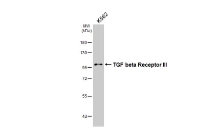 Anti-TGF beta Receptor III antibody [HL2895] used in Western Blot (WB). GTX640232