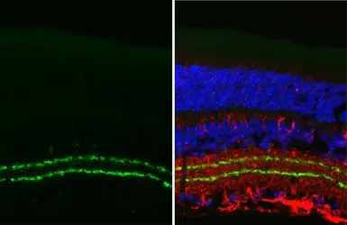 Anti-Vesicular Acetylcholine Transporter antibody [HL2900] used in IHC (Paraffin sections) (IHC-P). GTX640237